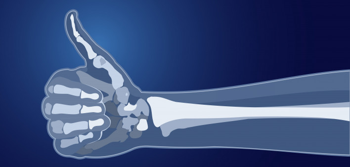 Bone Health Technologies Appoints Leading Osteoporosis Experts And Clinicians As Scientific Advisory Board Members